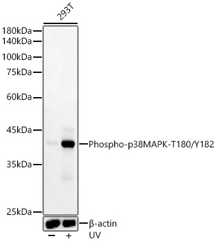 Phospho-p38 MAPK-T180/Y182 Rabbit mAb