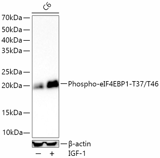 Phospho-eIF4EBP1-T37/T46 Rabbit mAb