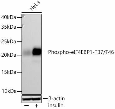 Phospho-eIF4EBP1-T37/T46 Rabbit mAb